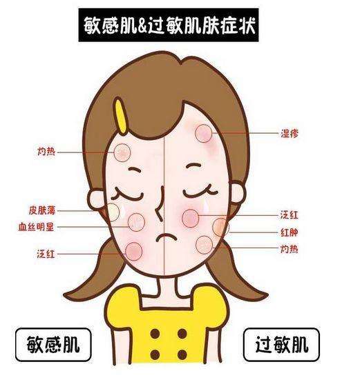 敏感肌肤和皮肤过敏，原来不是一回事？(图1)